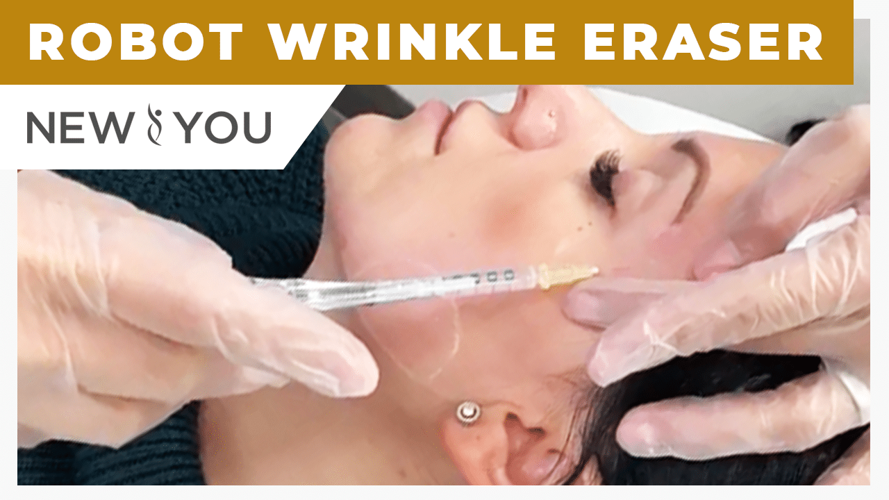 VIDEO: Client Tries The Robot Wrinkle Eraser