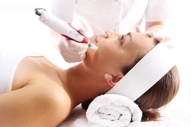 Get Major Results With Microneedling