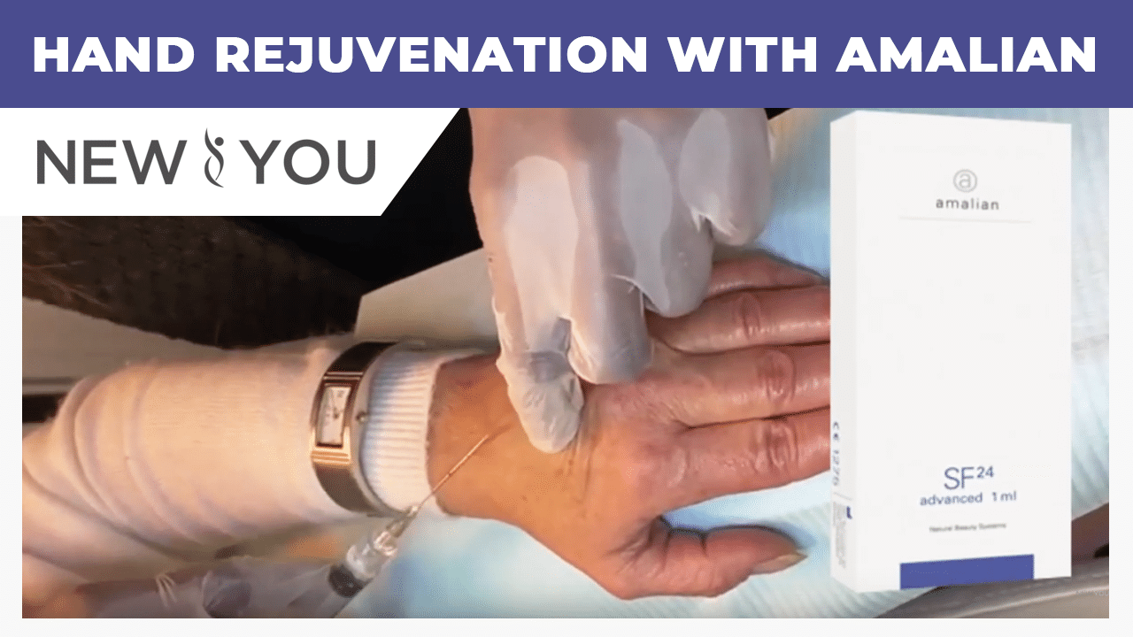 VIDEO: Hand Rejuvenation With Amalian SF