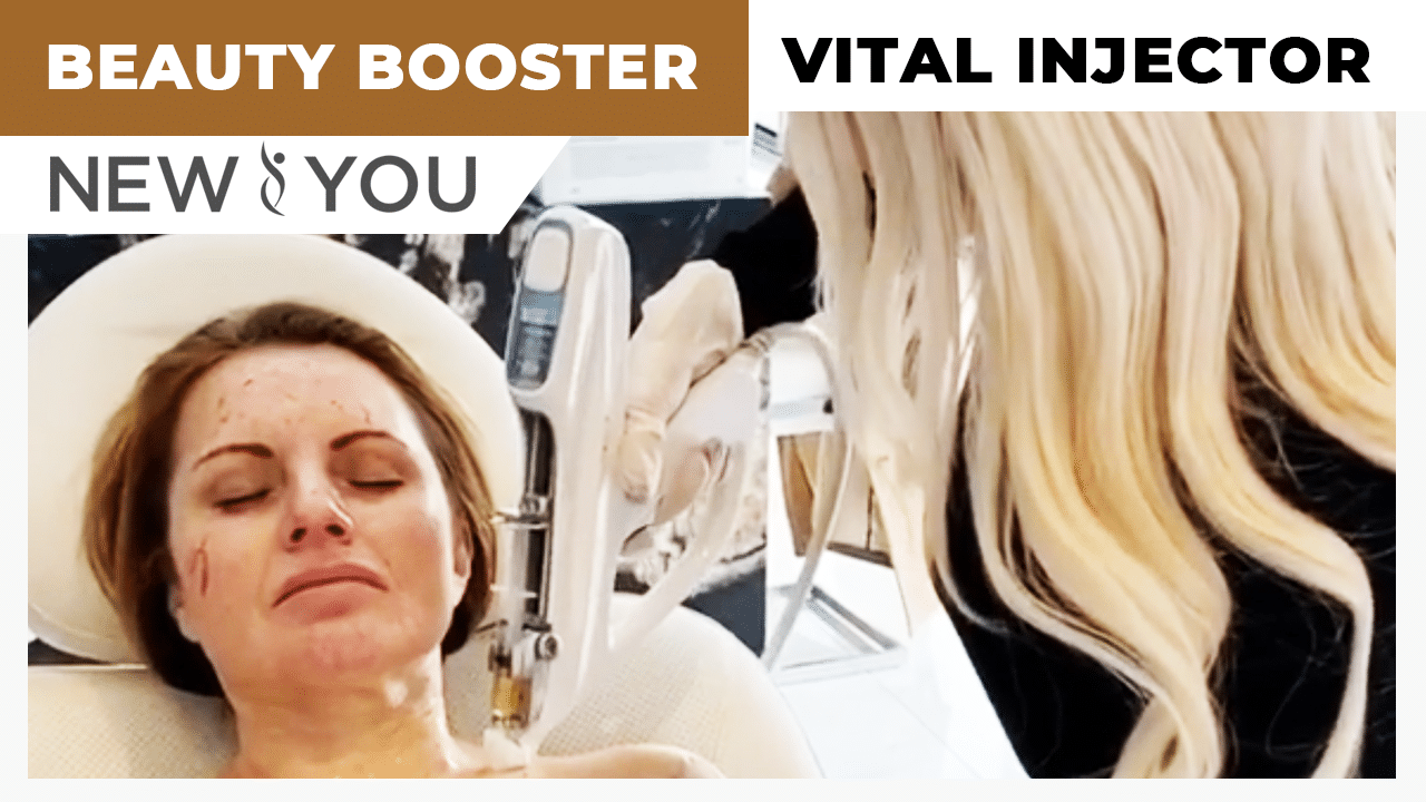 VIDEO: The Beauty Booster! Vital Injector